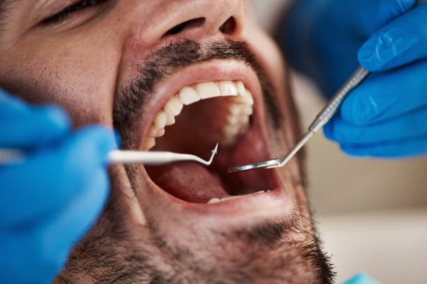 Best Emergency Root Canal Therapy in Elwood, KS